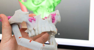 Un congresso internazionale discute le potenzialità della stampa in 3-D in Medicina