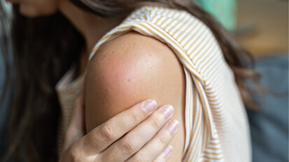 Verdachtsmeldungen unerwünschter Impfreaktionen veröffentlicht Verdachtsmeldungen unerwünschter Impfreaktionen veröffentlicht