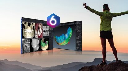 Introducing Planmeca Romexis 6.0—new version of world-leading software