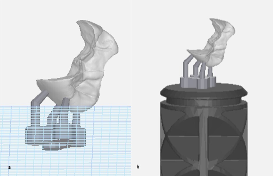 Figs. 11a & b: Virtual design of the inlay with supports added (a) and on the build platform (b).