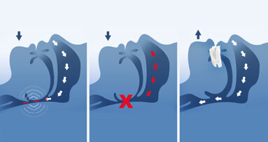 Dentsply Sirona and Panthera Dental announce collaboration for custom-made sleep devices