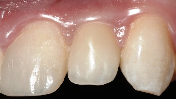 Model oparty na prostocie