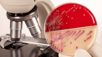 Antibakterielle ­Beschichtungen untersucht