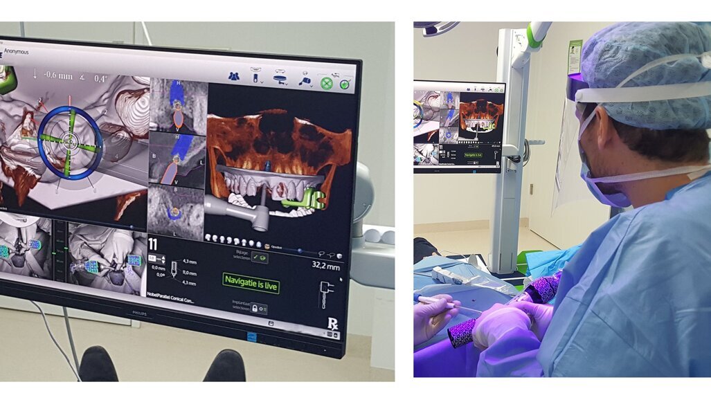 University College of Dentistry workshop demonstrates All-on-4 implants