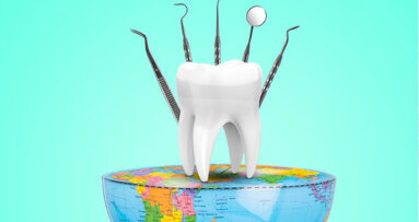 Weltweite Ungleichheiten im Bereich der Mundgesundheit