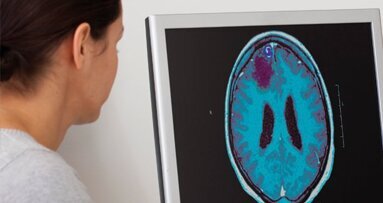 L’epilessia nel bambino: aspetti odontoiatrici e ortodontici