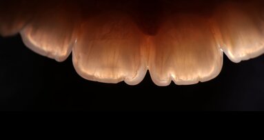 Short fibres, long-term vision: Protecting the tooth, not just the restoration