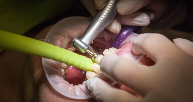 Stanowisko FDI wobec leczenia zachowawczego i próchnicy głębokiej