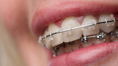 KFO im Fokus des Bayerischen Zahnärztetages