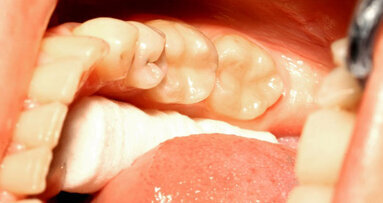 BPA kan in speeksel en urine terechtkomen