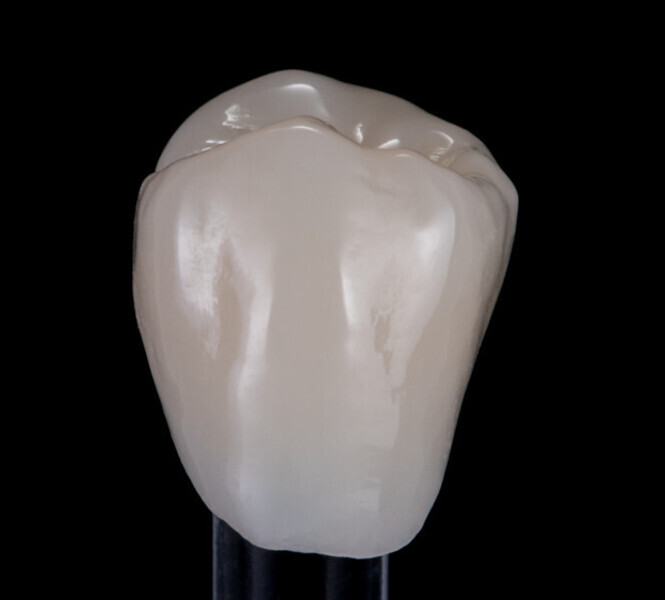 Fig. 5: The crown milled from GC Initial LiSi Block and finished without additional firing.