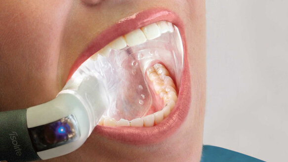 Scottsdale Center for Dentistry selects Isolite dental isolation