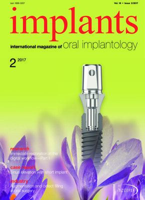 implants international No. 2, 2017 implants international No. 2, 2017