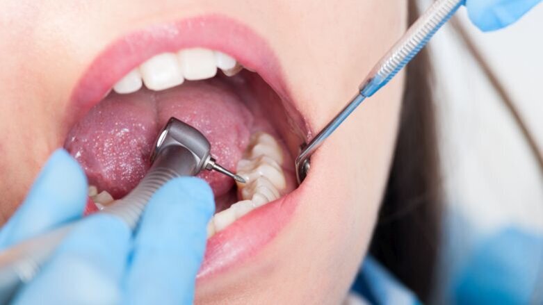 Relatie mondgezondheid en algemene gezondheid nog weinig bekend