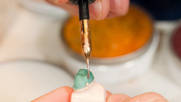 日本种植手术治疗失败率高