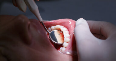 Twee derde kankerpatiënten heeft mond- of gebitsproblemen