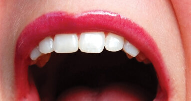 For jaw cancer patients, in-house 3-D printing allows quicker restoration of teeth