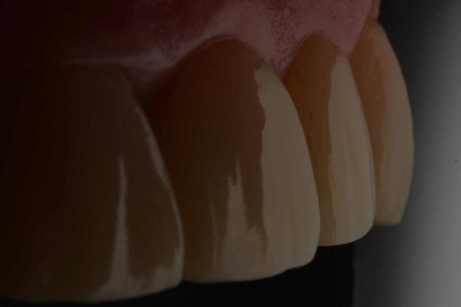 Hoogglans kan perfect bereikt worden. Een mooi emergence profiel kan worden gezien.