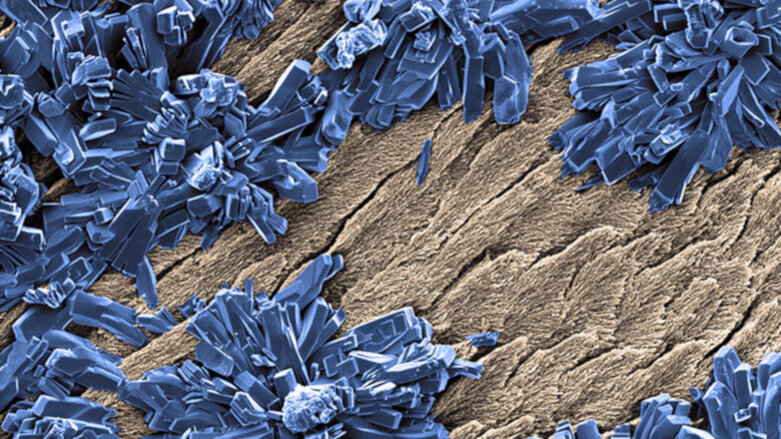 Blanchiment des dents : Les effets du peroxyde de carbamide sur les cellules dentaires