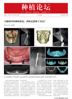 Implant Tribune China No. 4, 2017