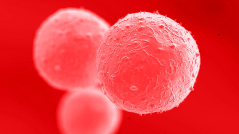 Matične ćelije iz koštane srži presađene u vilicu pacijenta