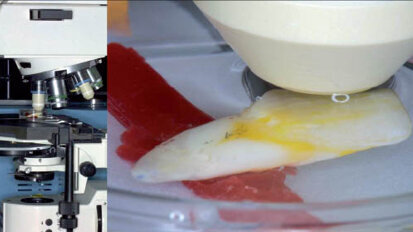 Struktura povrchu skloviny po bělení pohledem konfokálního mikroskopu