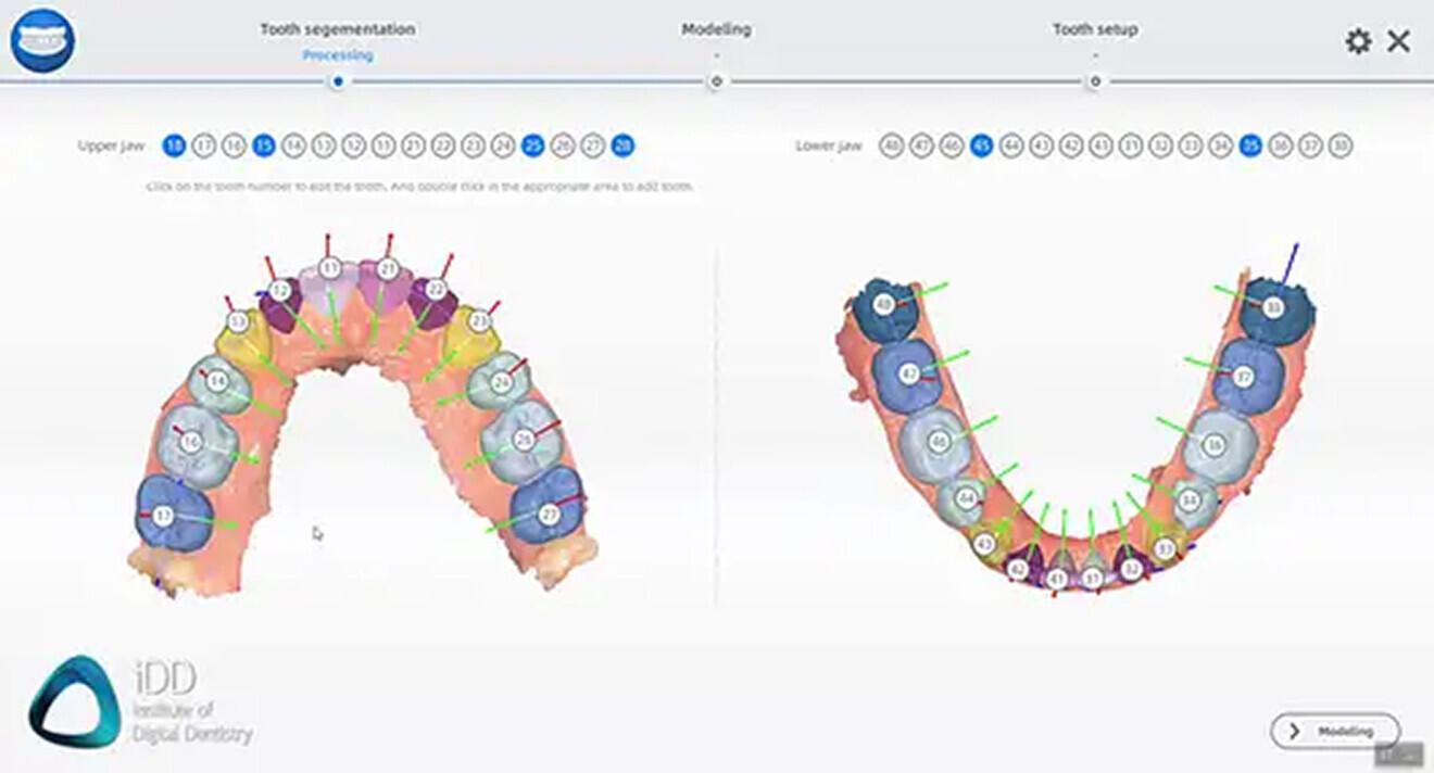 Fig. 16 & 17: Ortho simulation using Aoralscan 3 is automated and efcient.