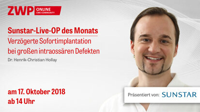 Am 17. Oktober: Sunstar Live-OP ab 14 Uhr Am 17. Oktober: Sunstar Live-OP ab 14 Uhr