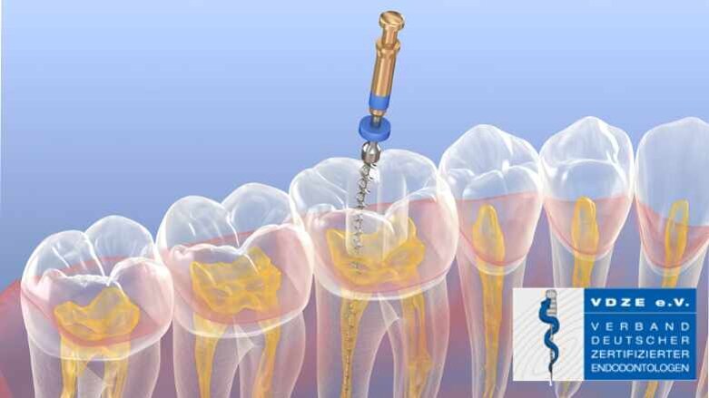 Aufruf zur Falleinreichung für den Endo-Award 2022