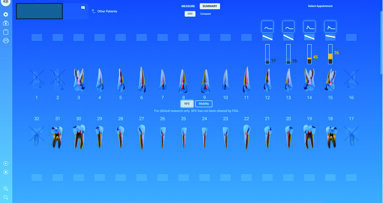 Beyond X-rays: How InnerView is changing the way we quantify implant stability Beyond X-rays: How InnerView is changing the way we quantify implant stability