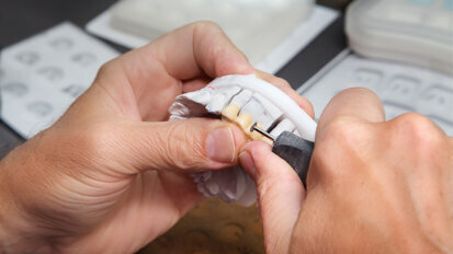 Arbeitgeberverband Zahntechnik zur Neuregelung des TSVG Arbeitgeberverband Zahntechnik zur Neuregelung des TSVG