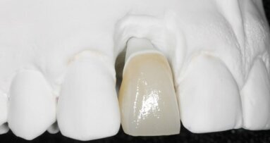 Indywidualizowane łączniki protetyczne konstruowane techniką CAD/CAM