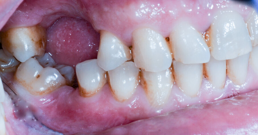 Figg. 1a, 1b - Situazione iniziale.