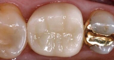 25 lat sprawdzonej klinicznej wydajności