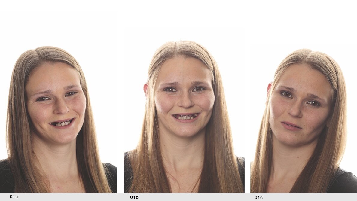 Una nueva sonrisa para Andrea