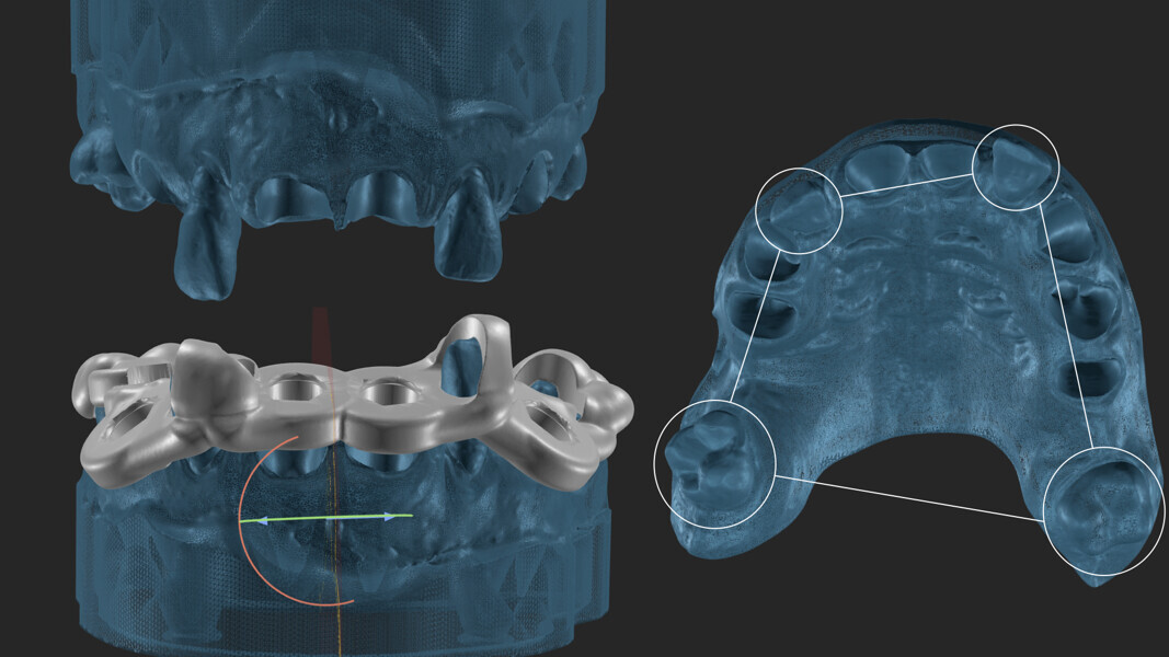 Fig. 13: Guide planning and design.