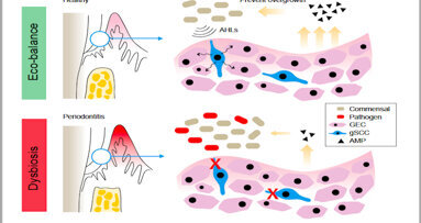 Study identifies gingival cells that can protect against periodontitis.