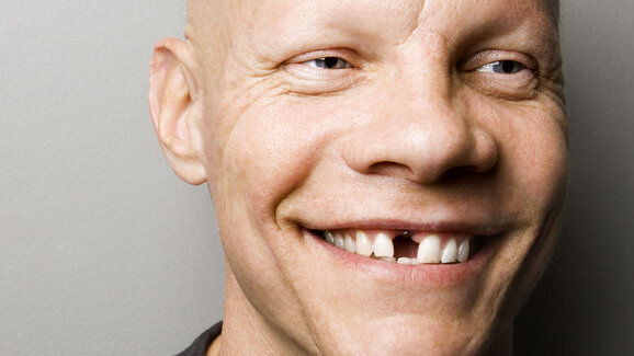 Brza i jednostavna kompozitna restauracija