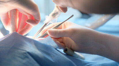 Single-session endodontic and surgical approach to internal root resorption: A long-term case report