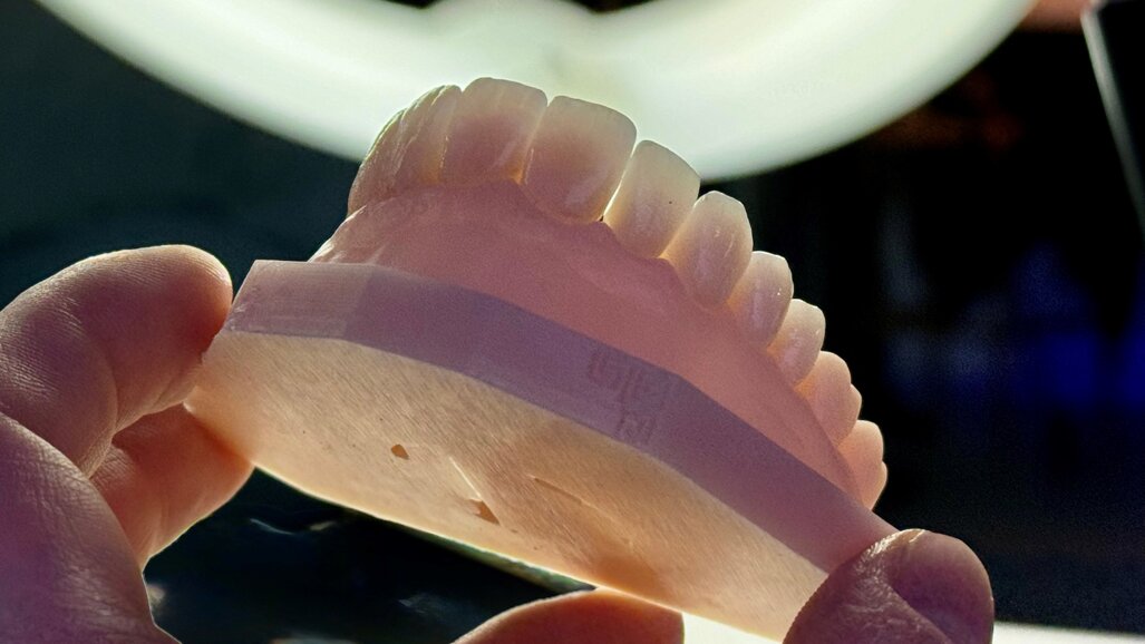 Milling or printing? The reliable path to definitive restorations