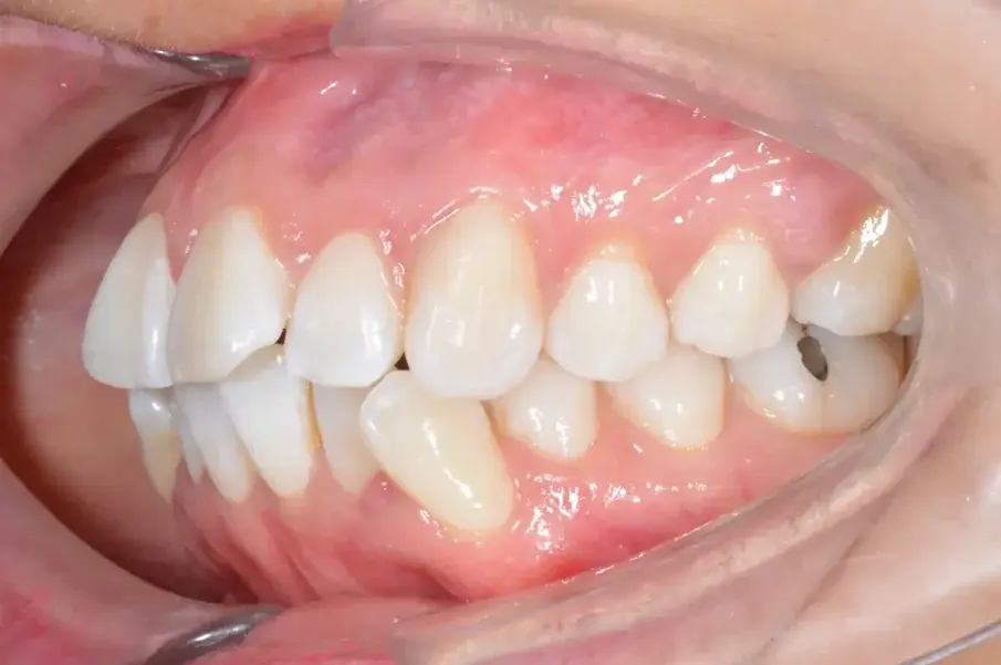 Фиг. 2c: Първоначални интраорални изображения.