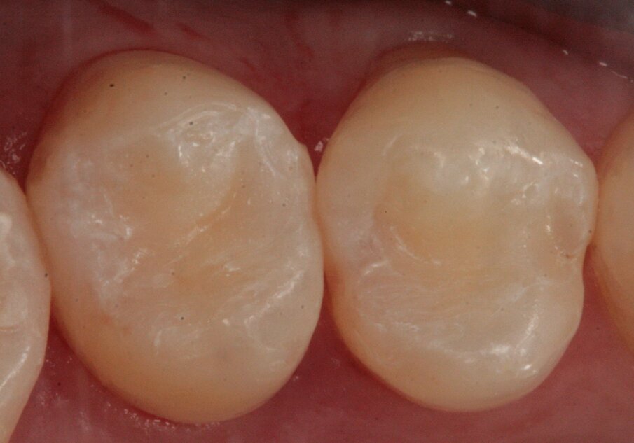 Fig. 11_Restauri effettuati.