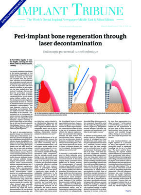 Implant Tribune Middle East & Africa No. 2, 2020