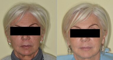 Caso di estetica multidisciplinare