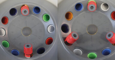 Co dělat a nedělat při manipulaci s fibrinem bohatým na krevní destičky (PRF)