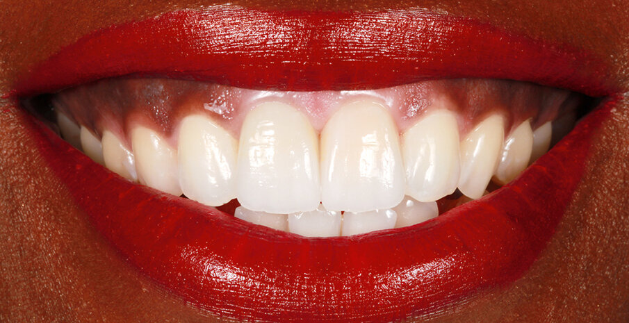 Fig. 19: … and provide a high brightness effect in direct light due to the high level of opalescence and fluorescence.