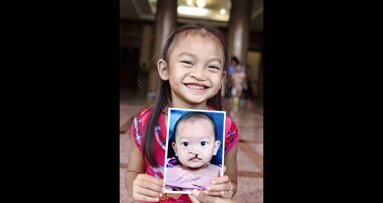 MiSmile founder shares the central role philanthropy plays in the business