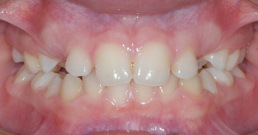 Fig. 10_Normalizzazione permuta.