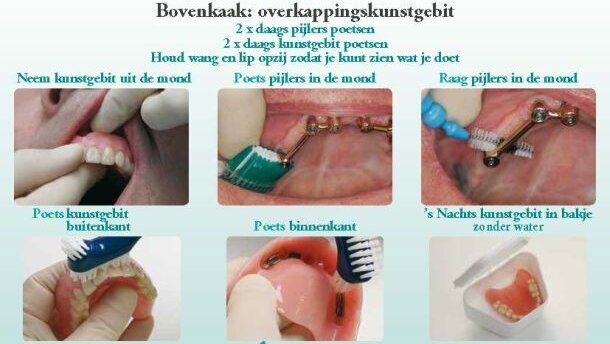 KNMT presenteert praktische hulpmiddelen mondzorg ouderen