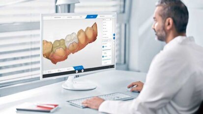 L’aggiornamento del software CEREC 5.3 aumenta la flessibilità del flusso di lavoro ed espande la capacità di produzione con l’integrazione di DS Core